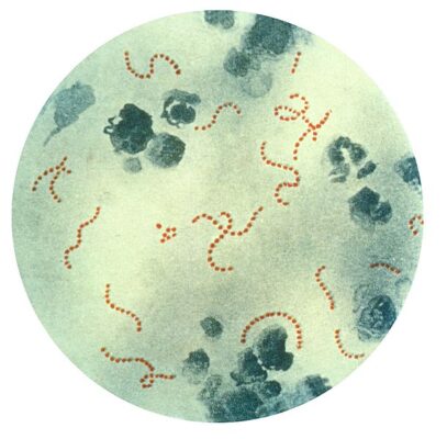 611px-Streptococcus_pyogenes_01