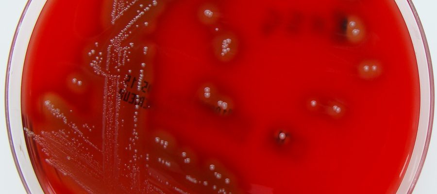 Streptococcus_pyogenes_(Lancefield_Group_A)_on_Columbia_Horse_Blood_Agar
